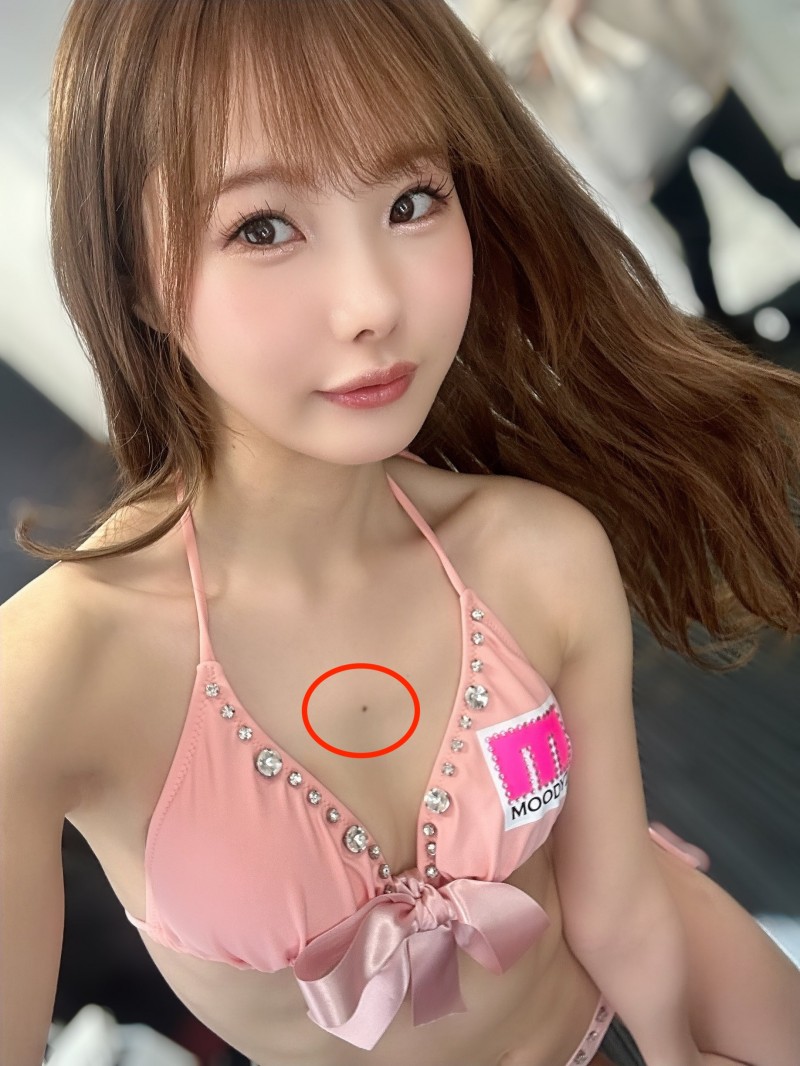 松本いちか(松本一香):这两个地方的痣别修掉!
